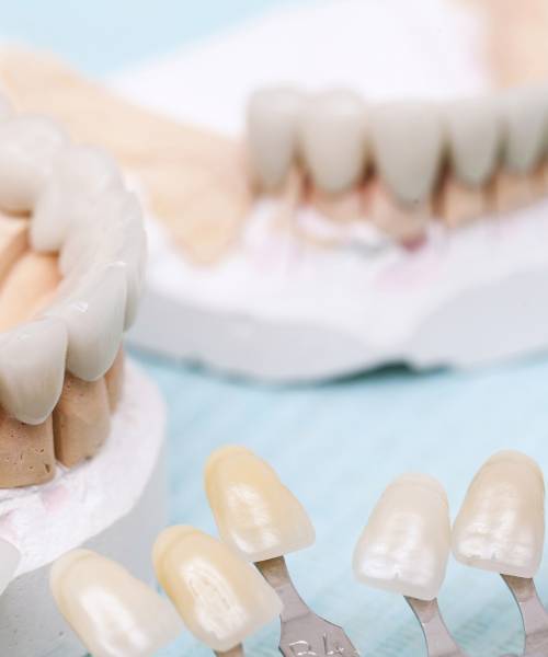 Протезирование зубов Протезирование зубов