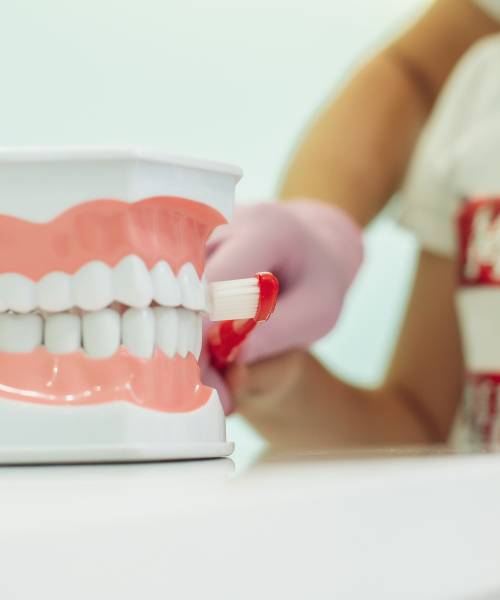 Отбеливание зубов Beyond Polus Отбеливание зубов Beyond Polus