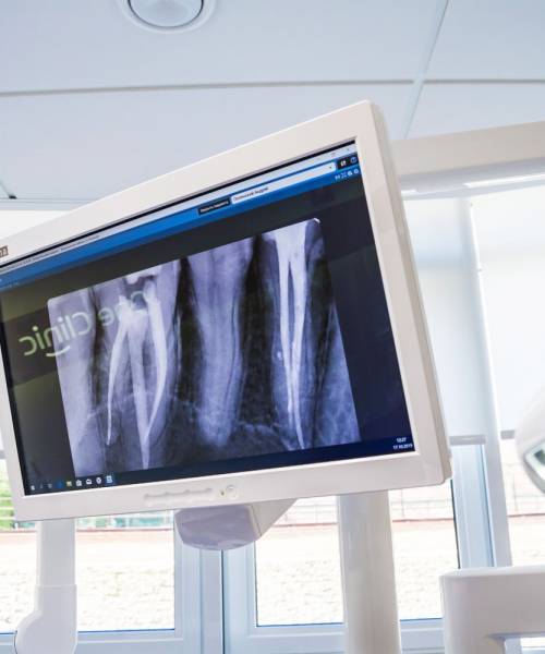 Имплантация зубов Имплантация зубов